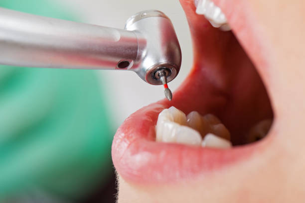 Best Emergency Treatment for Toothache in Ohioville, PA